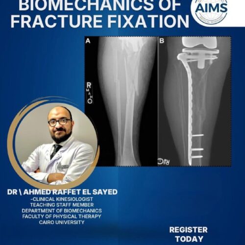 Biomechanics Of Fracture Fixation